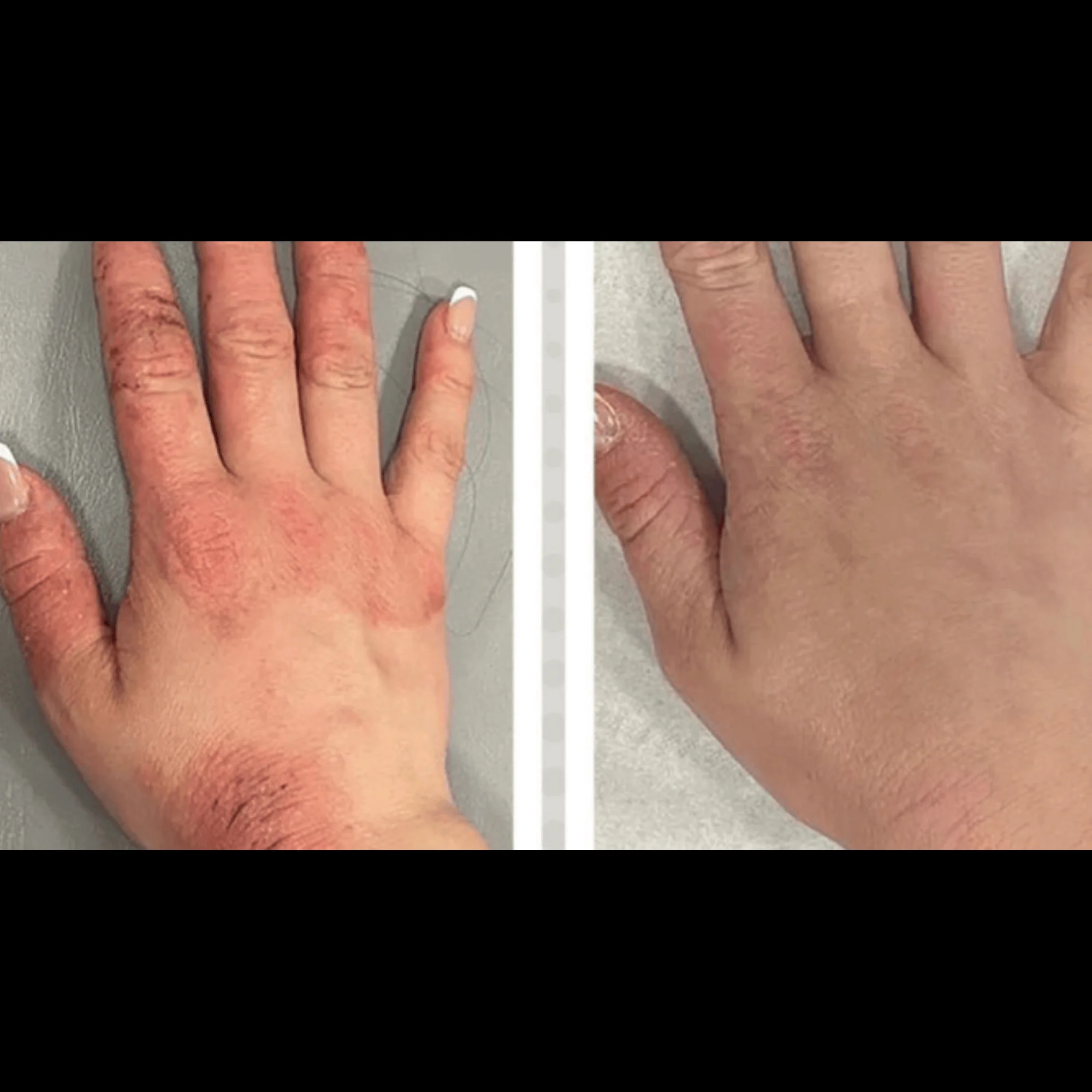 Hand Glow – LED Light Therapy for Hand & Wrist Rejuvenation by Numiere - Lumina NRG - Image 4